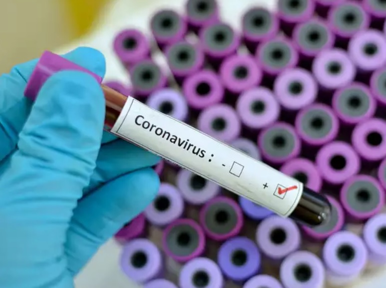 Coronavirus: ulteriori misure per il contrasto e il contenimento del contagio. Informativa per il lavoro agile
